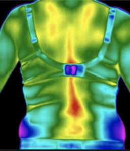 Imagerie thermique après traitement ostéopathique Florian Gaubert 