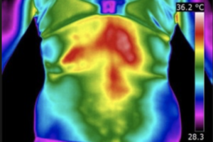 L’imagerie thermique au service de l’ostéopathie