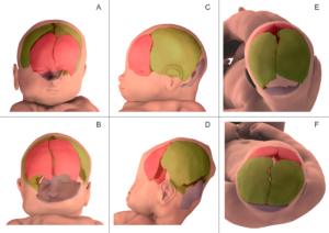 Lire la suite à propos de l’article La déformation du crâne du nourrisson observée lors de l’accouchement