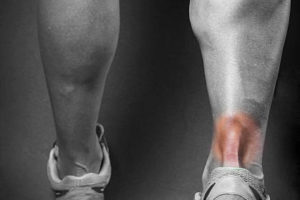 Ostéopathie et tendinite du tendon d’Achille