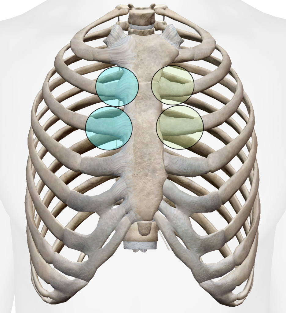 Siège anatomique de la douleur du syndrome de Tietze sur le thorax par Florian Gaubert, ostéopathe à Uchaud dans le Gard 