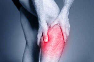 Ostéopathie et syndrome de compression du nerf tibial par Florian Gaubert, ostéopathe à Uchaud dans le Gard
