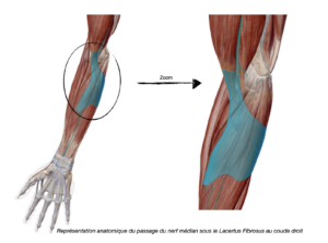 Représentation anatomique du passage du nerf médian sous le Lacertus Fibrosus au coude droit par Florian Gaubert, ostéopathe à Uchaud dans le Gard